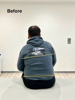 みずき/体の歪み施術前