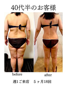 エステサロンクオーツ/全身痩身コース