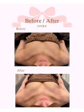 ロココ 安城店(Rococo)/バストアップ症例