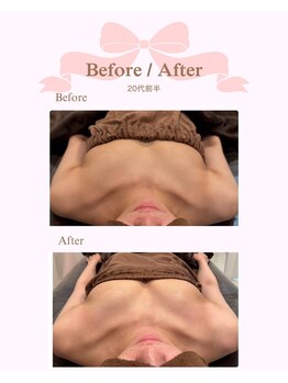 ロココ 安城店(Rococo)/バストアップ症例