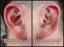 ルース(LUZ)/メンズ耳つぼコンディショニング