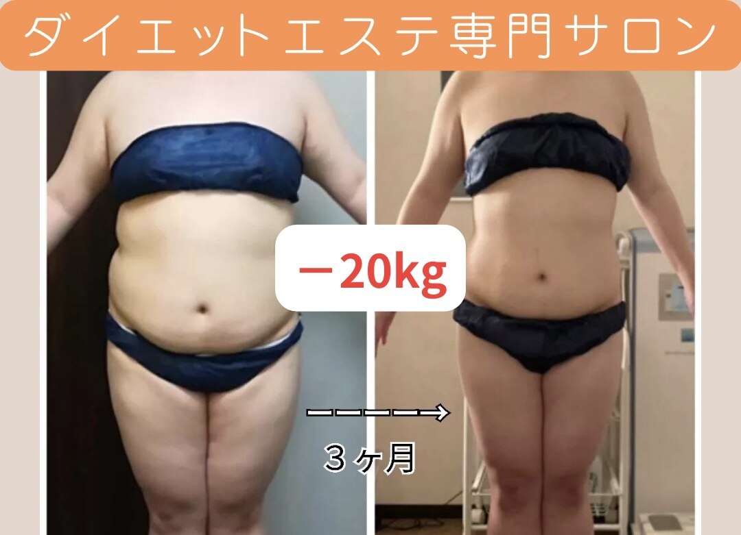 ダイエット サポート(DIET SUPPORT)｜ホットペッパービューティー