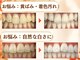 LBSホワイトニング 梅田店の写真