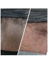 リボーン(Reboorn)/CS60＋オリジナルジェル