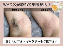アルゴ 前橋店(ALGO)の雰囲気（最新美肌脱毛とWAXの併用が可能◎仕上がりに感動☆即日ツルスベ）