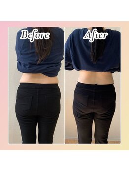 すばる整体院 小牧/ダイエット/産後骨盤矯正/小牧