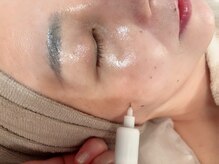 【肌荒れ＆シミケア】何をしても効果が感じられなかった方に