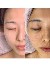 リトルーム(Litroom: from Seoul)/センシティブトリートメント