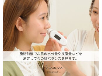 アミーカリーナ 阪急塚口店(Amicarina)/スキンチェック