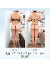 エスプレッソ(espresso,)/【6回】で後ろ姿が変わる♪