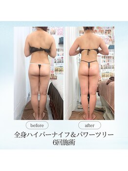 エスプレッソ(espresso,)/【6回】で後ろ姿が変わる♪