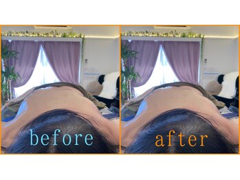 リセットモア(Reset More)/ハンドセラピス/自律神経に特化