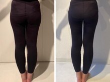 ザ エスアップ 博多店(THE S-UP)/施術前後写真