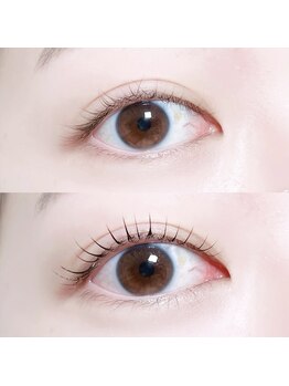 コーネリア(Cornelia)/before/after