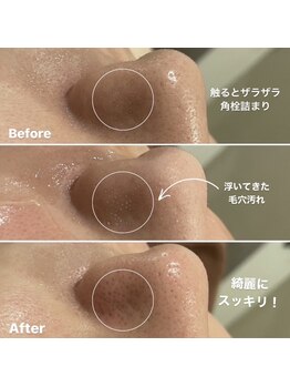 ミエル 神戸店(Miel)/浮かせて落とす毛穴汚れ!