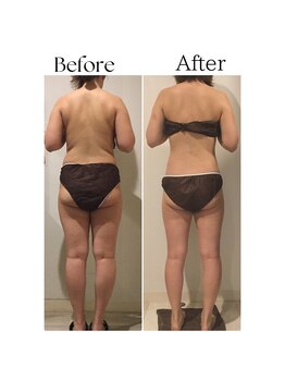 ラヴィニティ 五反田店(Lavinity)/五反田駅で痩身が人気のエステ