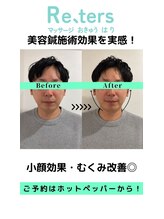 リターズ鍼灸治療所 天王寺院/Before-After