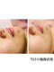 マヒナ(Mahina)の写真/【手技×マシン×エクソソーム】理想の小顔◆デコルテまで丁寧にほぐしてスッキリ美しいフェイスラインに!!
