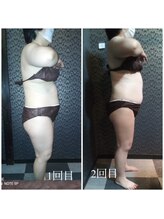 ラクラク(rakuraku)/痩身【全身】1～2回目