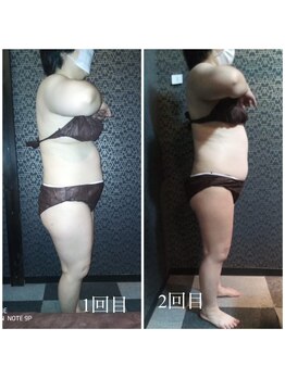 ラクラク(rakuraku)/痩身【全身】1~2回目