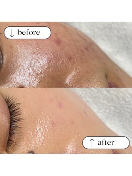 トータルビューティーサロンリア(Li'a)/ビフォー＆アフター