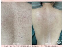 スリジエ ボーテ(cerisierBEAUTE)/根本改善結果重視CLAYハーブ*