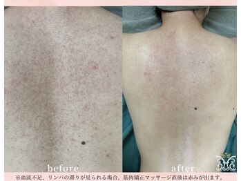 スリジエ ボーテ(cerisierBEAUTE)/根本改善結果重視CLAYハーブ*