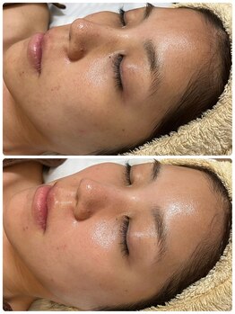 ジェニー(JENNI)/スキンメイド 2回の変化