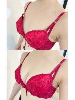 美人バスト 町田店/バストアップ◇症例◇