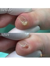 巻き爪補正店 鎌倉大船店/