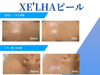 ラヴィニティ 南越谷店(Lavinity)/セラピール