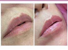 リル(relle)の雰囲気（話題のローマピンク！メイクなしで綺麗な唇に。キャンペーン中★）