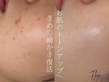 フレキシ 表参道(Flexi)