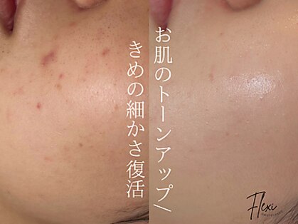 フレキシ 表参道(Flexi)の写真