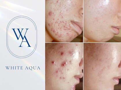 ホワイトアクア 中目黒店(WHITE AQUA)の写真