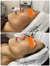 カフー(KAFUU)/クリスティーナ/ビタミンC/美白