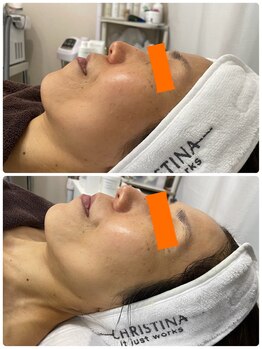 カフー(KAFUU)/クリスティーナ/ビタミンC/美白