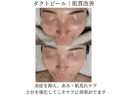 オンド(OND)の写真