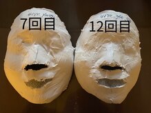 パール/石膏パックのビフォーアフター