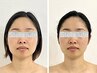面長卒業!憧れの小顔へ【エラ張】脳洗浄+最強小顔整体140分￥22000