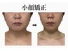 【No. 1★】小顔矯正×肩甲骨はがし120分 姿勢改善で小顔効果増大*初回40%OFF