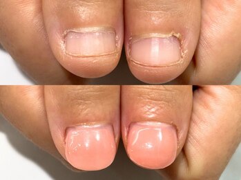 120分でノンストレスになる指先