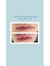 ウルト アルティメイトスキン(ULT ultimate skin)/パークリップ