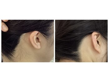 エレーナ 虎ノ門(Elena)/うなじ すっきり