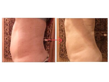 ラシュシュ モイ(moi)