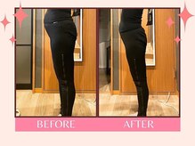 ヨサパーク 美キレイ 仙台店(YOSAPARK 美 Kirei)/短期集中！ビフォーアフター