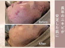 エヴァル(ewalu)/ー ４ヶ月の変化 ー