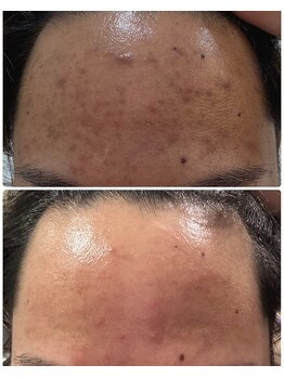 リノミラ(LINOMIRA)の写真/医療提携だからこそできるお肌に特化した施術をご提供！的確な施術で結果に導きます。お仕事帰りにも◎