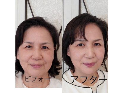 カロン(Karon)の写真