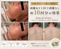 ダイヤモンド リーエンダ(Diamond leende)